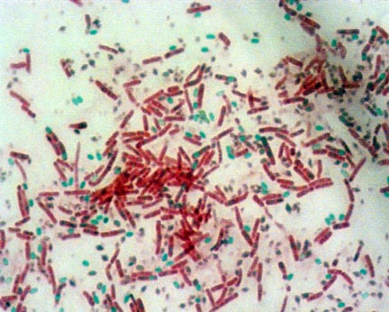 endospore stain