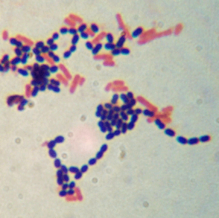 gram stain